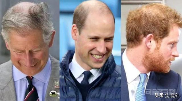 威廉王子的发型一直被各大英媒吐槽，是基因遗传还是英国的水质问题？