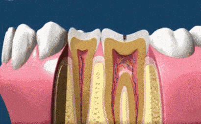 牙齿上裹层“膜”，竟能让牙齿再生，烂牙变好牙！家家都有这材料