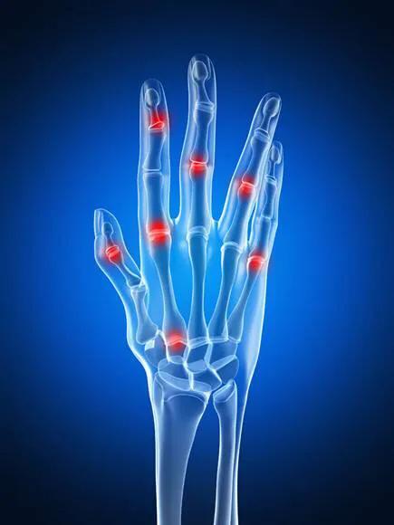 手指头里面疼痛的原因引起的 手指疼痛是什么原因