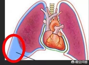  肺癌患者为什么会出现胸膜的转移？